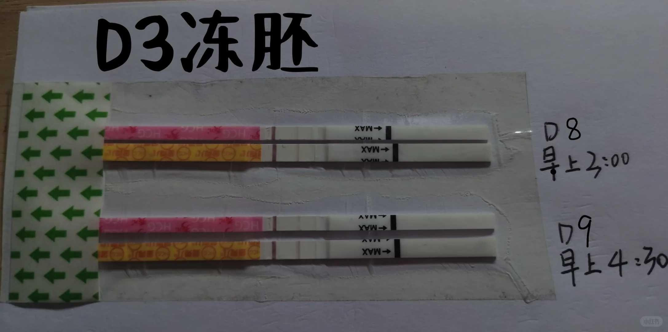 柬埔寨代生哪家中介好！子宫内膜厚度多少才算正常标准