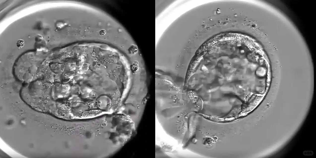 大连供卵助孕包成功