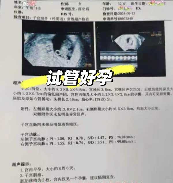 人造子宫来了，未来女性不用单身做试管了？