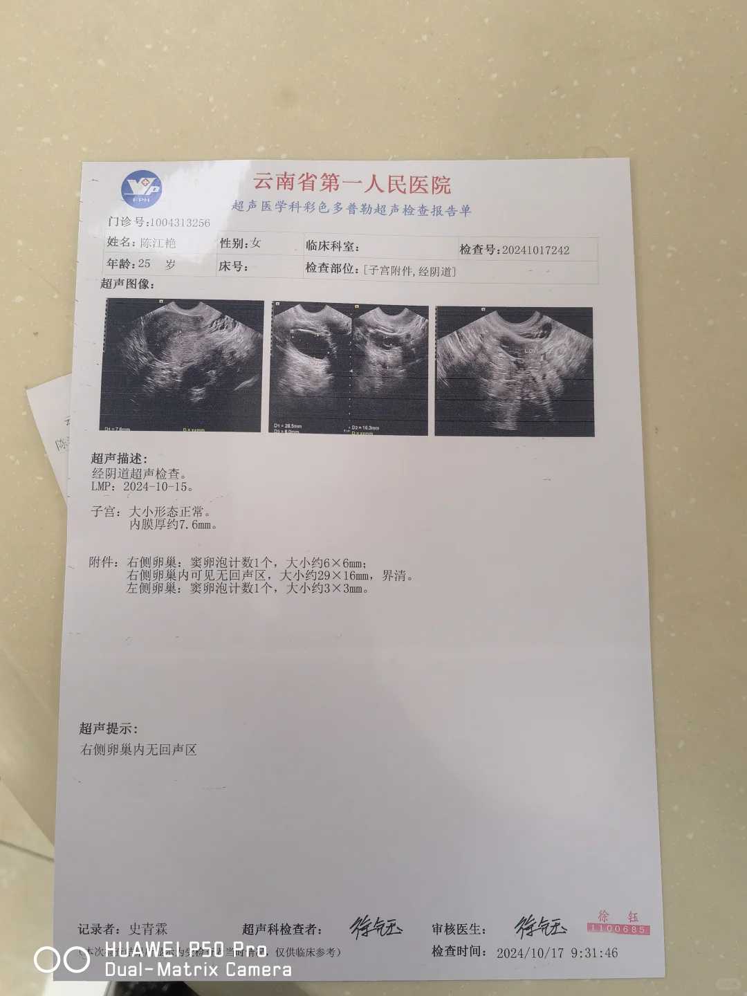 中国哪里代孕_试管做男孩费用,做试管还要准生证吗？