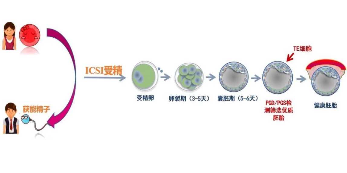 绝经借卵做试管婴儿40岁能做吗有影响吗