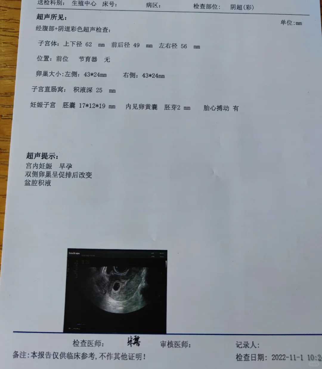 广州供卵得来坤和助孕预约,供卵自怀先来坤和助孕预约