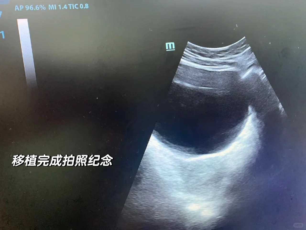 乐宝代孕机构,头疼、舌头疼、嗓子疼...孕妇上火的8大症状表现盘点